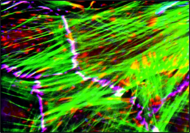 <B>Immunofluorescence</B><BR/>A computer-generated micrograph showing the superimposed immunofluorescent staining of chicken lens cells using FITC-phalloidin (green), Monoclonal Anti-Human Vinculin, clone No. hVIN-1 (<B>Cat. No. V9131</B>) (red) and Rabbit Anti-Pan Cadherin (<B>Cat. No. C3678</B>) (blue). Focal contacts appear yellow and intercellular junctions white. <BR/>From Prof. B. Geiger, Prof. Z. Kam and T. Volberg, Weizmann Institute of Science, Rehovot, Israel.