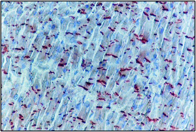 <B>Immunohistochemistry</B><BR/>Immunoperoxidase staining of a formalin-fixed, paraffin-embedded section of human heart using Rabbit Anti-Pan Cadherin (<B>Cat. No. C3678</B>).