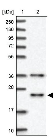 <B>Immunoblotting</B><BR/>Anti-MID1IP1: <B>Cat. No. HPA038816</B>: <BR/><B>Lane</B><BR/>1. Marker [kDa] 250, 130, 95, 72, 55, 36, 28, 17, 10<BR/>2. Human cell line RT-4