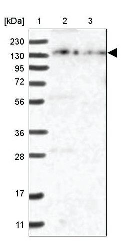 <B>Immunoblotting</B><BR/>Anti-ZFYVE16: <B>Cat. No. HPA035935</B>: <BR/><B>Lane</B><BR/>1. Marker [kDa] 230, 130, 95, 72, 56, 36, 28, 17, 11<BR/>2. Human cell line RT-4<BR/>3. Human cell line U-251 MG sp