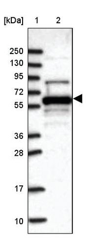 <B>Immunoblotting</B><BR/>Anti-METTL14: <B>Cat. No. HPA038002</B>: <BR/><B>Lane</B><BR/>1. Marker [kDa] 250, 130, 95, 72, 55, 36, 28, 17, 10<BR/>2. Human cell line RT-4