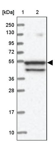 <B>Immunoblotting</B><BR/>Anti-SPATA7: <B>Cat. No. HPA038083</B>: <BR/><B>Lane</B><BR/>1. Marker [kDa] 250, 130, 95, 72, 55, 36, 28, 17, 10<BR/>2. Human cell line RT-4