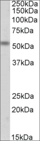 <B>Immunoblotting</B><BR/>Anti-CHRNE<B>Cat. No. SAB2501975</B>: Immunoblotting (1 μg/mL) staining of Mouse Fetal Skeletal Muscle lysate (35 μg protein in RIPA buffer). Primary incubation was 1 hour. Detected by chemiluminescence.