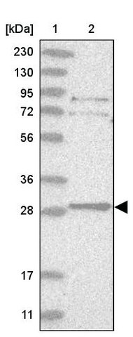 <B>Immunoblotting</B><BR/>Anti-TXNDC9: <B>Cat. No. HPA031845</B>: <BR/><B>Lane</B><BR/>1. Marker [kDa] 230, 130, 95, 72, 56, 36, 28, 17, 11<BR/>2. Human cell line RT-4