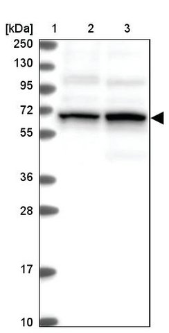 <B>Immunoblotting</B><BR/>Anti-TCHP: <B>Cat. No. HPA038638</B>: <BR/><B>Lane</B><BR/>1. Marker [kDa] 250, 130, 95, 72, 55, 36, 28, 17, 10<BR/>2. Human cell line RT-4<BR/>3. Human cell line U-251 MG sp