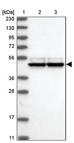 <B>Immunoblotting</B><BR/>Anti-TRNT1: <B>Cat. No. HPA036938</B>: <BR/><B>Lane</B><BR/>1. Marker [kDa] 230, 130, 95, 72, 56, 36, 28, 17, 11<BR/>2. Human cell line RT-4<BR/>3. Human cell line U-251 MG sp