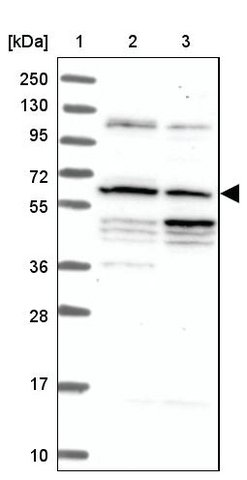 <B>Immunoblotting</B><BR/>Anti-C10orf68: <B>Cat. No. HPA039300</B>: <BR/><B>Lane</B><BR/>1. Marker [kDa] 250, 130, 95, 72, 55, 36, 28, 17, 10<BR/>2. Human cell line RT-4<BR/>3. Human cell line U-251 MG sp