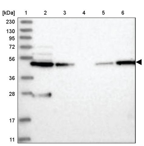 <B>Immunoblotting</B><BR/>Anti-WDR37: <B>Cat. No. HPA037376</B>: <BR/><B>Lane</B><BR/>1. Marker [kDa] 230, 130, 95, 72, 56, 36, 28, 17, 11<BR/>2. Human cell line RT-4<BR/>3. Human cell line U-251 MG sp<BR/>4. Human plasma (IgG/HSA depleted)<BR/>5. Human liver tissue<BR/>6. Human tonsil tissue