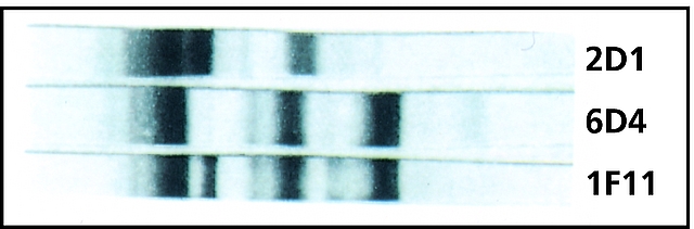 <B>Immunoblotting</B><BR/>Reactivities of Anti-Calmodulin monoclonal antibodies with proteolytic fragements of <I>Dictyostelium</I> calmodulin. Purified <I>Dictyostelium</I> calmodulin (100 μg) was partially digested with clostripain. The proteolytic products were resolved by SDS-PAGE and transferred to a PVDF membrane for 3 hours. The primary antibodies were clone 1F11 (<B>Cat. No. C0931</B>), clone 6D4 (<B>Cat. No. C3545</B>) and clone 2D1 (<B>Cat. No. C6167</B>). <BR/>From Hulen, D., et al., Cell Motil. Cytoskel., <B>18</B>, 113 (1991). Courtesy of Dr. J. L. Salisbury, Mayo<SUP>®</SUP> Clinic, Rochester, MN.