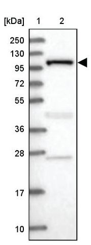 <B>Immunoblotting</B><BR/>Anti-INPP4B: <B>Cat. No. HPA037682</B>: <BR/><B>Lane</B><BR/>1. Marker [kDa] 250, 130, 95, 72, 55, 36, 28, 17, 10<BR/>2. Human cell line RT-4