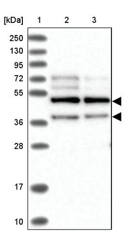 <B>Immunoblotting</B><BR/>Anti-PPHLN1: <B>Cat. No. HPA038902</B>: <BR/><B>Lane</B><BR/>1. Marker [kDa] 250, 130, 95, 72, 55, 36, 28, 17, 10<BR/>2. Human cell line RT-4<BR/>3. Human cell line U-251 MG sp