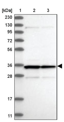 <B>Immunoblotting</B><BR/>Anti-LRRC59: <B>Cat. No. HPA030829</B>: <BR/><B>Lane</B><BR/>1. Marker [kDa] 230, 130, 95, 72, 56, 36, 28, 17, 11<BR/>2. Human cell line RT-4<BR/>3. Human cell line U-251 MG sp