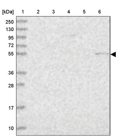 <B>Immunoblotting</B><BR/>Anti-PSAPL1: <B>Cat. No. HPA038013</B>: <BR/><B>Lane</B><BR/>1. Marker [kDa] 250, 130, 95, 72, 55, 36, 28, 17, 10<BR/>2. Human cell line RT-4<BR/>3. Human cell line U-251 MG sp<BR/>4. Human plasma (IgG/HSA depleted)<BR/>5. Human liver tissue<BR/>6. Human tonsil tissue