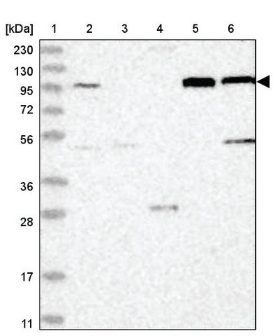 <B>Immunoblotting</B><BR/>Anti-COPB2: <B>Cat. No. HPA036867</B>: <BR/><B>Lane</B><BR/>1. Marker [kDa] 230, 130, 95, 72, 56, 36, 28, 17, 11<BR/>2. Human cell line RT-4<BR/>3. Human cell line U-251 MG sp<BR/>4. Human plasma (IgG/HSA depleted)<BR/>5. Human liver tissue<BR/>6. Human tonsil tissue