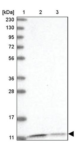 <B>Immunoblotting</B><BR/>Anti-PCBD1: <B>Cat. No. HPA037575</B>: <BR/><B>Lane</B><BR/>1. Marker [kDa] 230, 130, 95, 72, 56, 36, 28, 17, 11<BR/>2. Human cell line RT-4<BR/>3. Human cell line U-251 MG sp