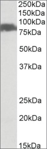 <B>Immunoblotting</B><BR/>Anti-SLC26A6<B>Cat. No. SAB2501960</B>: Immunoblotting (0.1 μg/mL) staining of Human Pancreas lysate (35 μg protein in RIPA buffer). Primary incubation was 1 hour. Detected by chemiluminescence.