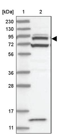 <B>Immunoblotting</B><BR/>Anti-ACAP2: <B>Cat. No. HPA034807</B>: <BR/><B>Lane</B><BR/>1. Marker [kDa] 230, 130, 95, 72, 56, 36, 28, 17, 11<BR/>2. Human cell line RT-4