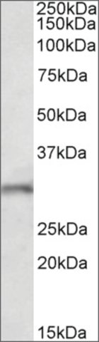 <B>Immunoblotting</B><BR/>Anti-Fgf14 (N-terminal) <B>Cat. No. SAB2502137</B>: Immunoblotting (1 μg/mL) staining of Mouse Brain lysate (35 μg protein in RIPA buffer). Primary incubation was 1 hour. Detected by chemiluminescence.