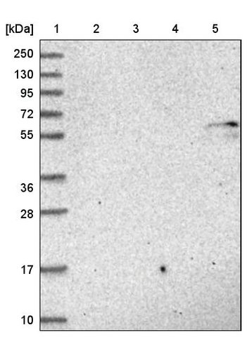 <B>Immunoblotting</B><BR/>Anti-CYP46A1: <B>Cat. No. HPA040702</B>: <BR/><B>Lane</B><BR/>1. Marker [kDa] 250, 130, 95, 72, 55, 36, 28, 17, 10<BR/>2. Human cell line RT-4<BR/>3. Human cell line U-251 MG sp<BR/>4. Human plasma (IgG/HSA depleted)<BR/>5. Human liver tissue