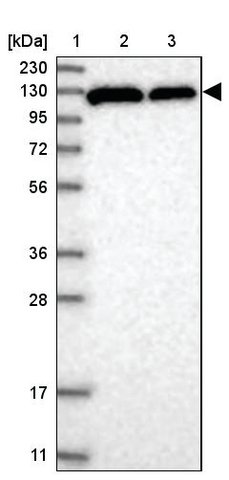 <B>Immunoblotting</B><BR/>Anti-TDRD1: <B>Cat. No. HPA037730</B>: <BR/><B>Lane</B><BR/>1. Marker [kDa] 230, 130, 95, 72, 56, 36, 28, 17, 11<BR/>2. Human cell line RT-4<BR/>3. Human cell line U-251 MG sp