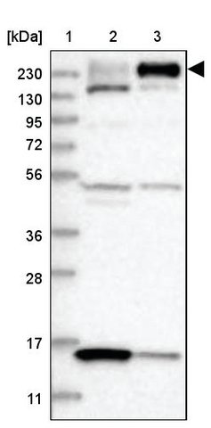 <B>Immunoblotting</B><BR/>Anti-ARAP2: <B>Cat. No. HPA035925</B>: <BR/><B>Lane</B><BR/>1. Marker [kDa] 230, 130, 95, 72, 56, 36, 28, 17, 11<BR/>2. Human cell line RT-4<BR/>3. Human cell line U-251 MG sp