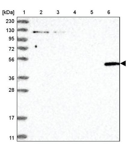 <B>Immunoblotting</B><BR/>Anti-LGSN: <B>Cat. No. HPA030957</B>: <BR/><B>Lane</B><BR/>1. Marker [kDa] 230, 130, 95, 72, 56, 36, 28, 17, 11<BR/>2. Human cell line RT-4<BR/>3. Human cell line U-251 MG sp<BR/>4. Human plasma (IgG/HSA depleted)<BR/>5. Human liver tissue<BR/>6. Human tonsil tissue