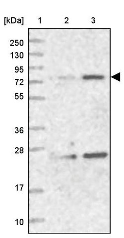 <B>Immunoblotting</B><BR/>Anti-NHLRC2: <B>Cat. No. HPA038493</B>: <BR/><B>Lane</B><BR/>1. Marker [kDa] 250, 130, 95, 72, 55, 36, 28, 17, 10<BR/>2. Human cell line RT-4<BR/>3. Human cell line U-251 MG sp