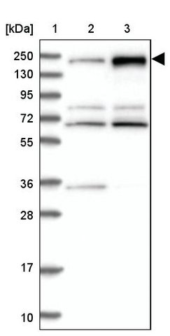 <B>Immunoblotting</B><BR/>Anti-PDS5B: <B>Cat. No. HPA040015</B>: <BR/><B>Lane</B><BR/>1. Marker [kDa] 250, 130, 95, 72, 55, 36, 28, 17, 10<BR/>2. Human cell line RT-4<BR/>3. Human cell line U-251 MG sp