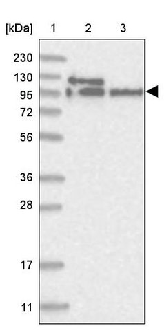 <B>Immunoblotting</B><BR/>Anti-LARP4B: <B>Cat. No. HPA036566</B>: <BR/><B>Lane</B><BR/>1. Marker [kDa] 230, 130, 95, 72, 56, 36, 28, 17, 11<BR/>2. Human cell line RT-4<BR/>3. Human cell line U-251 MG sp