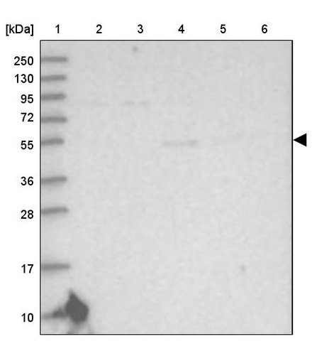 <B>Immunoblotting</B><BR/>Anti-SLC39A8: <B>Cat. No. HPA038833</B>: <BR/><B>Lane</B><BR/>1. Marker [kDa] 250, 130, 95, 72, 55, 36, 28, 17, 10<BR/>2. Human cell line RT-4<BR/>3. Human cell line U-251 MG sp<BR/>4. Human plasma (IgG/HSA depleted)<BR/>5. Human liver tissue<BR/>6. Human tonsil tissue