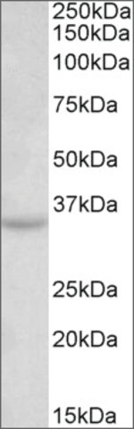 <B>Immunoblotting</B><BR/>Anti-TSPAN5 (N-terminal) <B>Cat. No. SAB2502124</B>: Immunoblotting (0.3 μg/mL) staining of Mouse Brain lysate (35 μg protein in RIPA buffer). Primary incubation was 1 hour. Detected by chemiluminescence.