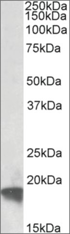 <B>Immunoblotting</B><BR/>Anti-ARF4<B>Cat. No. SAB2502089</B>: Immunoblotting (0.5 μg/mL) staining of HeLa lysate (35 μg protein in RIPA buffer). Primary incubation was 1 hour. Detected by chemiluminescence.