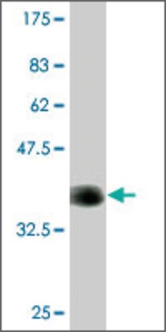 <B>Immunoblotting</B><BR/>Monoclonal Anti-CACNA1F: <B>Cat. No. SAB1403627</B>: Antibody concentration: 1 μg/mL. Specific band of ~37.1 kDa using immunogen protein lysate.