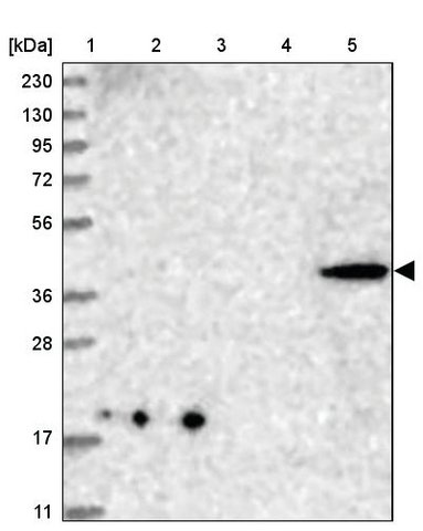 <B>Immunoblotting</B><BR/>Anti-CNTLN: <B>Cat. No. HPA036728</B>: <BR/><B>Lane</B><BR/>1. Marker [kDa] 230, 130, 95, 72, 56, 36, 28, 17, 11<BR/>2. Human cell line RT-4<BR/>3. Human cell line U-251 MG sp<BR/>4. Human plasma (IgG/HSA depleted)<BR/>5. Human liver tissue