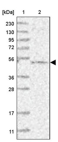 <B>Immunoblotting</B><BR/>Anti-CEP70: <B>Cat. No. HPA036942</B>: <BR/><B>Lane</B><BR/>1. Marker [kDa] 230, 130, 95, 72, 56, 36, 28, 17, 11<BR/>2. Human cell line RT-4
