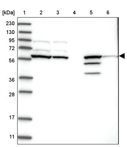 <B>Immunoblotting</B><BR/>Anti-CERKL: <B>Cat. No. HPA035444</B>: <BR/><B>Lane</B><BR/>1. Marker [kDa] 230, 130, 95, 72, 56, 36, 28, 17, 11<BR/>2. Human cell line RT-4<BR/>3. Human cell line U-251 MG sp<BR/>4. Human plasma (IgG/HSA depleted)<BR/>5. Human liver tissue<BR/>6. Human tonsil tissue