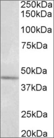 <B>Immunoblotting</B><BR/>Anti-Syt5<B>Cat. No. SAB2502087</B>: Immunoblotting (1 μg/mL) staining of Olfactory bulb lysate (35 μg protein in RIPA buffer). Primary incubation was 1 hour. Detected by chemiluminescence.