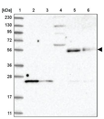 <B>Immunoblotting</B><BR/>Anti-UNC93A: <B>Cat. No. HPA035729</B>: <BR/><B>Lane</B><BR/>1. Marker [kDa] 230, 130, 95, 72, 56, 36, 28, 17, 11<BR/>2. Human cell line RT-4<BR/>3. Human cell line U-251 MG sp<BR/>4. Human plasma (IgG/HSA depleted)<BR/>5. Human liver tissue<BR/>6. Human tonsil tissue