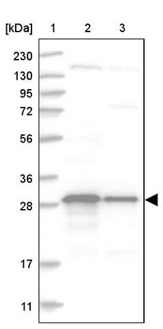 <B>Immunoblotting</B><BR/>Anti-TXNDC9: <B>Cat. No. HPA031846</B>: <BR/><B>Lane</B><BR/>1. Marker [kDa] 230, 130, 95, 72, 56, 36, 28, 17, 11<BR/>2. Human cell line RT-4<BR/>3. Human cell line U-251 MG sp