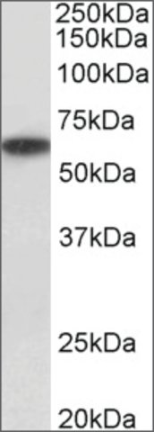 <B>Immunoblotting</B><BR/>Anti-P2rx4<B>Cat. No. SAB2502047</B>: Immunoblotting (1 μg/mL) staining of Human Kidney lysate (35 μg protein in RIPA buffer). Primary incubation was 1 hour. Detected by chemiluminescence.