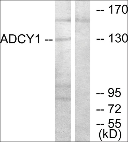 <B>Immunoblotting</B><BR/>Anti-ADCY1: <B>Cat. No. SAB4300903</B>: Western blot analysis of extracts from COLO205 cells using Anti-ADCY1 antibody.