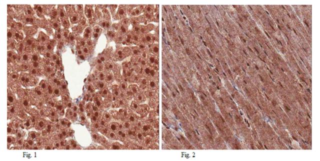 Immunohistochemistry Analysis: <br />Representative lot data. <br />Formalin Fixed Paraffin Embedded (FFPE) mouse liver (Fig. 1) and mouse cardiac muscle (Fig. 2) tissues were prepared using heat-induced epitope retrieval (HIER). Immunostaining was performed using a 1:1,000 dilution of Cat. No. ABD75, THAP11 (Ronin). Reactivity was detected using an Anti-Rabbit secondary antibody and HRP-DAB. Positive nuclear and cytoplasmic staining was observed in both mouse liver and heart sections.