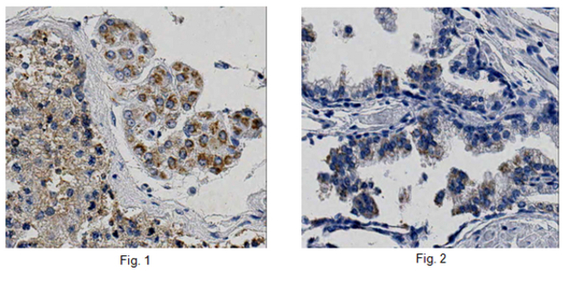 Immunohistochemistry Analysis:<br />Representative lot data.<br />Formalin Fixed Paraffin Embedded (FFPE) human testis (Fig. 1) and human prostate (Fig. 2) tissues were processed using heat-induced epitope retrieval (HIER). Immunostaining was performed using a 1:50 dilution of Cat. No. ABC930, Anti-PATE1. Reactivity was detected using an Anti-Rabbit secondary antibody and HRP-DAB. Cytoplasmic staining of Leydig cells and germ cells in human testis and cytoplasmic staining of epithelial cells in human prostate tissues was observed