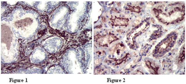 Immunohistochemistry Analysis: <br />Representative lot data. <br />Paraffin-embedded fibromuscular stroma of human prostate (figure 1) and distal and proximal convoluted tubules in human kidney (figure 2) tissues were prepared using heat-induced epitope retrieval in citrate buffer, pH 6.0. Immunostaining was performed using a 1:500 dilution of Cat. No. ABT60, Anti-Whamm. Reactivity was detected using the IHC-Select® Detection Kit (Cat. No. DAB050). Positive cytoplasmic staining.