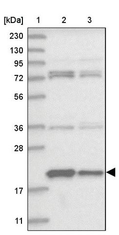 <B>Immunoblotting</B><BR/>Anti-CHCHD4: <B>Cat. No. HPA034688</B>: <BR/><B>Lane</B><BR/>1. Marker [kDa] 230, 130, 95, 72, 56, 36, 28, 17, 11<BR/>2. Human cell line RT-4<BR/>3. Human cell line U-251 MG sp