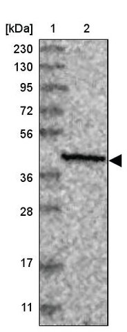 <B>Immunoblotting</B><BR/>Anti-SLC9B1: <B>Cat. No. HPA035435</B>: <BR/><B>Lane</B><BR/>1. Marker [kDa] 230, 130, 95, 72, 56, 36, 28, 17, 11<BR/>2. Human cell line RT-4