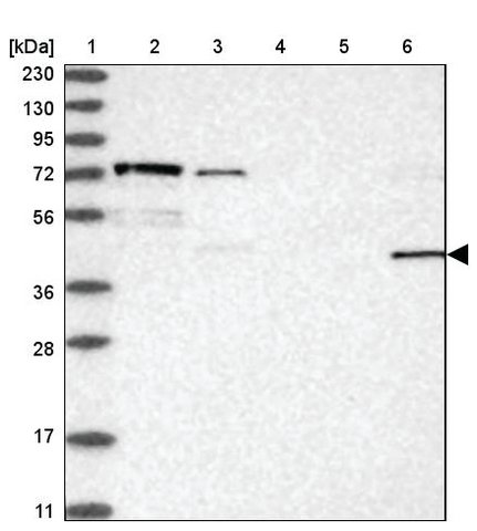 <B>Immunoblotting</B><BR/>Anti-FAM26E: <B>Cat. No. HPA034969</B>: <BR/><B>Lane</B><BR/>1. Marker [kDa] 230, 130, 95, 72, 56, 36, 28, 17, 11<BR/>2. Human cell line RT-4<BR/>3. Human cell line U-251 MG sp<BR/>4. Human plasma (IgG/HSA depleted)<BR/>5. Human liver tissue<BR/>6. Human tonsil tissue