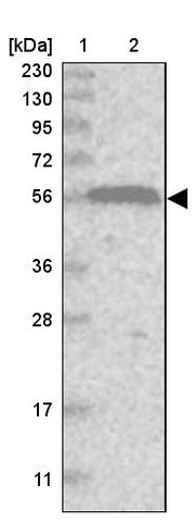 <B>Immunoblotting</B><BR/>Anti-RIN2: <B>Cat. No. HPA034641</B>: <BR/><B>Lane</B><BR/>1. Marker [kDa] 230, 130, 95, 72, 56, 36, 28, 17, 11<BR/>2. Human cell line RT-4