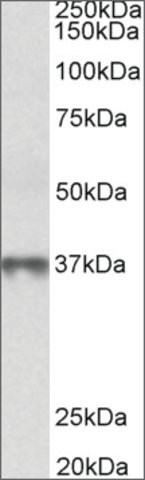 <B>Immunoblotting</B><BR/>Anti-MAT2B (N-terminal) <B>Cat. No. SAB2502086</B>: Immunoblotting (0.3 μg/mL) staining of Human Thymus lysate (35 μg protein in RIPA buffer). Primary incubation was 1 hour. Detected by chemiluminescence.