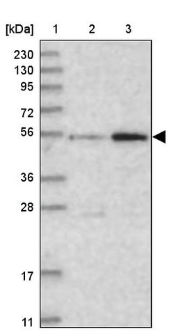 <B>Immunoblotting</B><BR/>Anti-FAM175B: <B>Cat. No. HPA037591</B>: <BR/><B>Lane</B><BR/>1. Marker [kDa] 230, 130, 95, 72, 56, 36, 28, 17, 11<BR/>2. Human cell line RT-4<BR/>3. Human cell line U-251 MG sp
